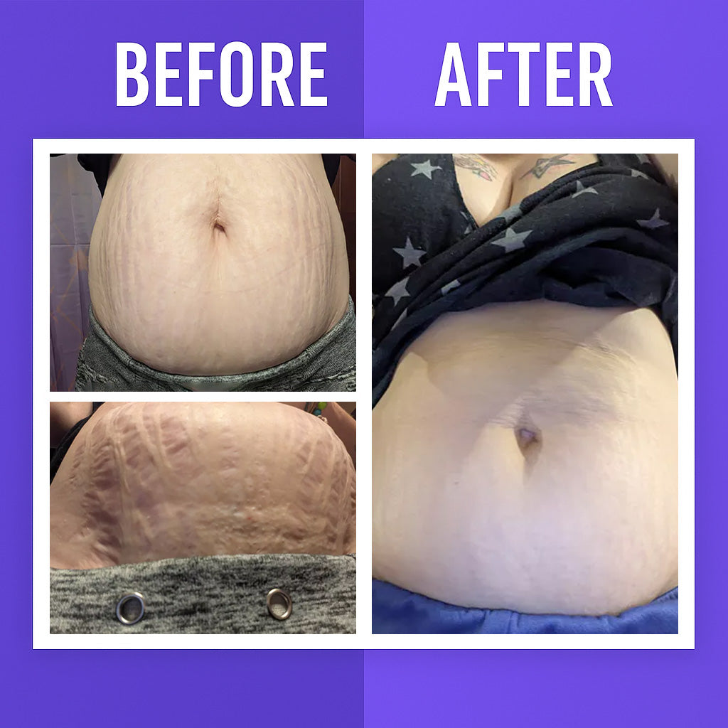 Viral Overnight Skin Tightening Body Whip