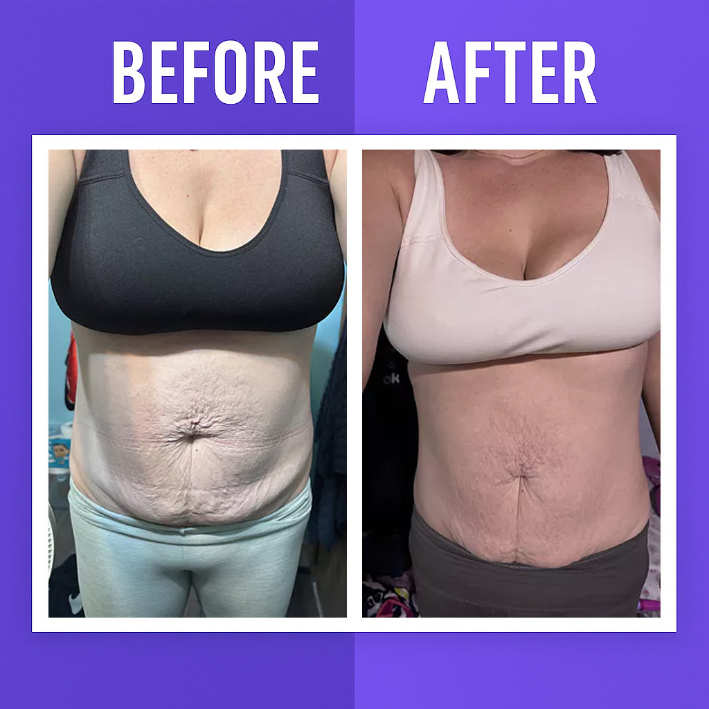Viral Overnight Skin Tightening Body Whip