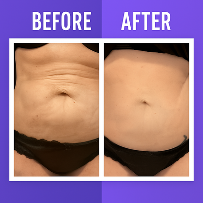 Viral Overnight Skin Tightening Body Whip